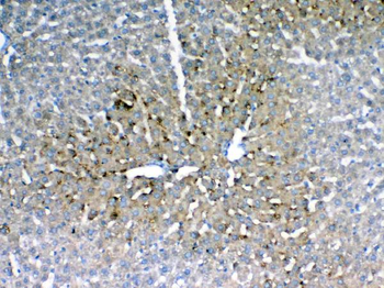 Anti-IGFBP1 Antibody