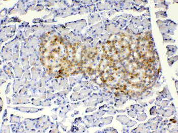 Anti-IGFBP1 Antibody