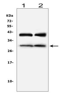Anti-IGFBP1 Antibody