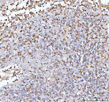 Anti-IL-22/IL22 Antibody