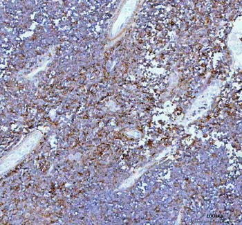 Anti-IL-22/IL22 Antibody
