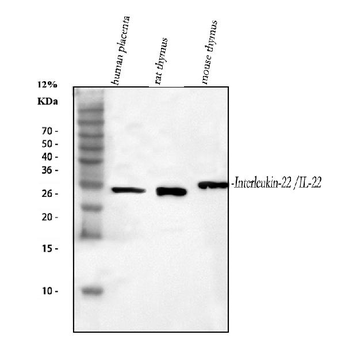 Anti-IL-22/IL22 Antibody