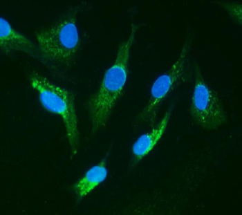 Anti-IRAK/IRAK1 Antibody