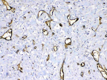 Anti-HBD Antibody