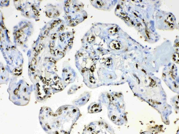 Anti-HBD Antibody