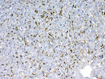 Anti-HBD Antibody