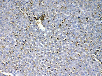 Anti-HBD Antibody