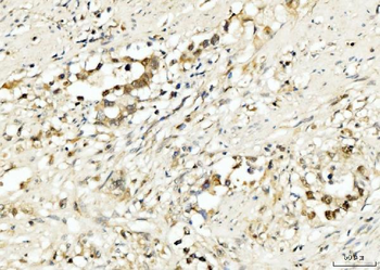 Anti-PDCD4 Antibody