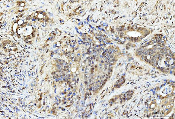 Anti-PDCD4 Antibody