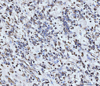 Anti-PDCD4 Antibody