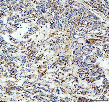 Anti-Factor D/CFD Antibody