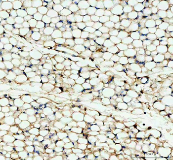 Anti-Factor D/CFD Antibody