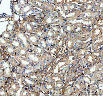 Anti-Factor D/CFD Antibody