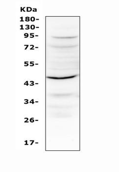 IL12B Antibody