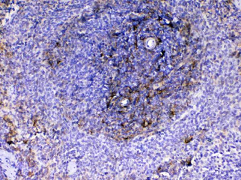 Anti-VCAM1 Antibody