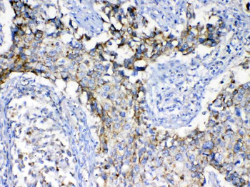 Anti-SCF/KITLG Antibody
