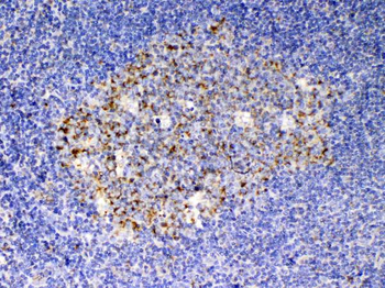 Anti-SCF/KITLG Antibody