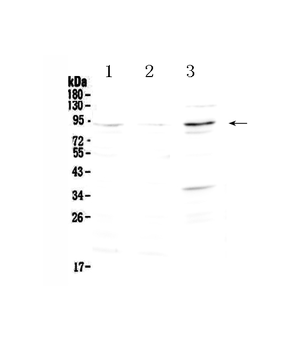 FOXP2 Rabbit Polyclonal Antibody