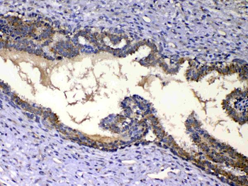 Anti-IGFBP2 Antibody