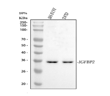 Anti-IGFBP2 Antibody