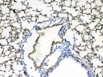 Anti-Periostin/Postn Antibody