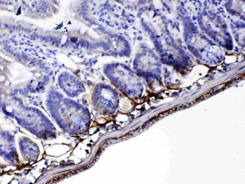 Anti-Periostin/Postn Antibody