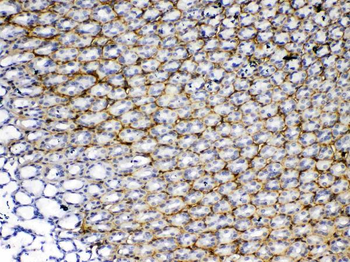 Anti-Periostin/Postn Antibody
