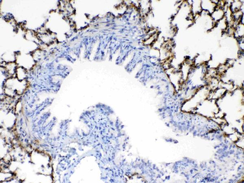 Anti-Periostin/Postn Antibody