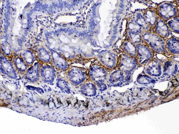 Anti-Periostin/Postn Antibody