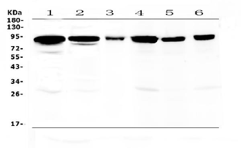 Anti-Periostin/Postn Antibody