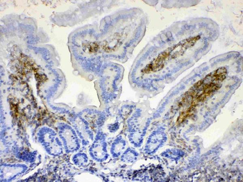 Anti-Lyn Antibody