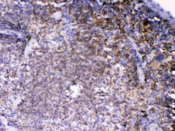 Anti-Lyn Antibody