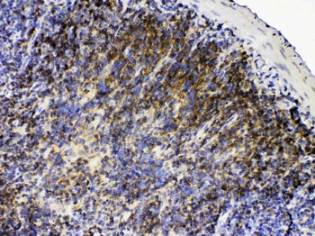 Anti-Lyn Antibody