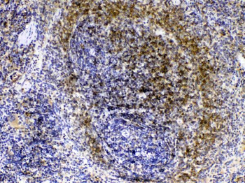 Anti-Lyn Antibody