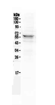 Anti-Lyn Antibody