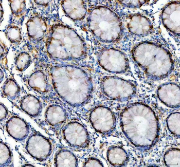 Anti-GALT Antibody