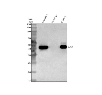 Anti-GALT Antibody