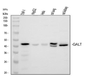 Anti-GALT Antibody