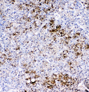 Anti-GSTA1/A2/A3/A4/A5 Antibody