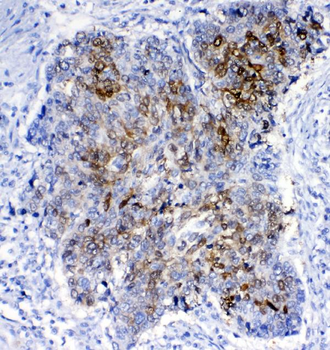 Anti-GSTA1/A2/A3/A4/A5 Antibody
