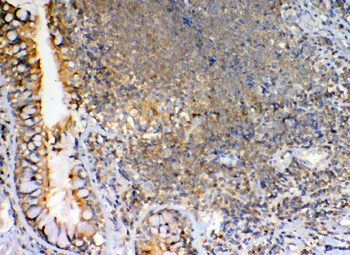 Anti-GRK2/GRK2 Antibody