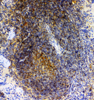 Anti-GRK2/GRK2 Antibody