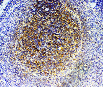 Anti-GRK2/GRK2 Antibody