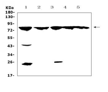 Anti-GRK2/GRK2 Antibody
