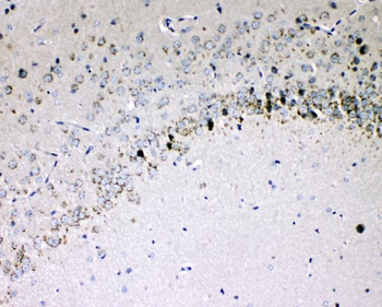 Anti-IL-16/Il16 Antibody