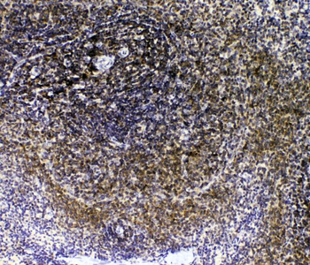 Anti-IL-16/Il16 Antibody