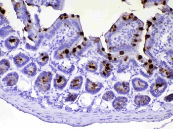 Anti-TFF3 Antibody