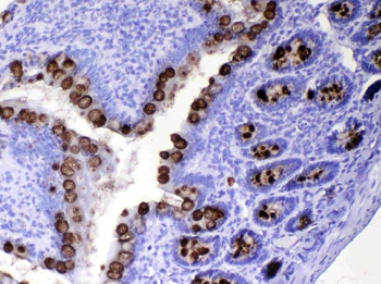Anti-TFF3 Antibody