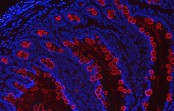 Anti-TFF3 Antibody