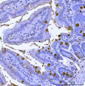 Anti-TFF3 Antibody